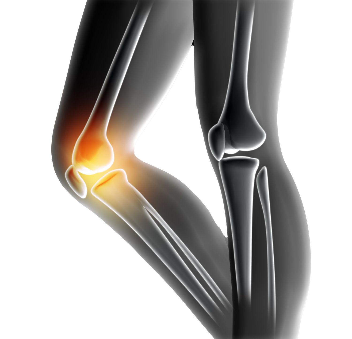 Joint & Knee Assessment